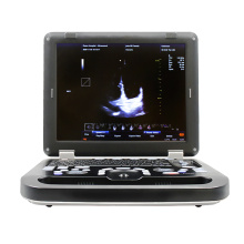 Contec CMS1700C Big Big Oltrasoned Ultrasonund Machine Color Doppler Medical Ultrasoned Instruments